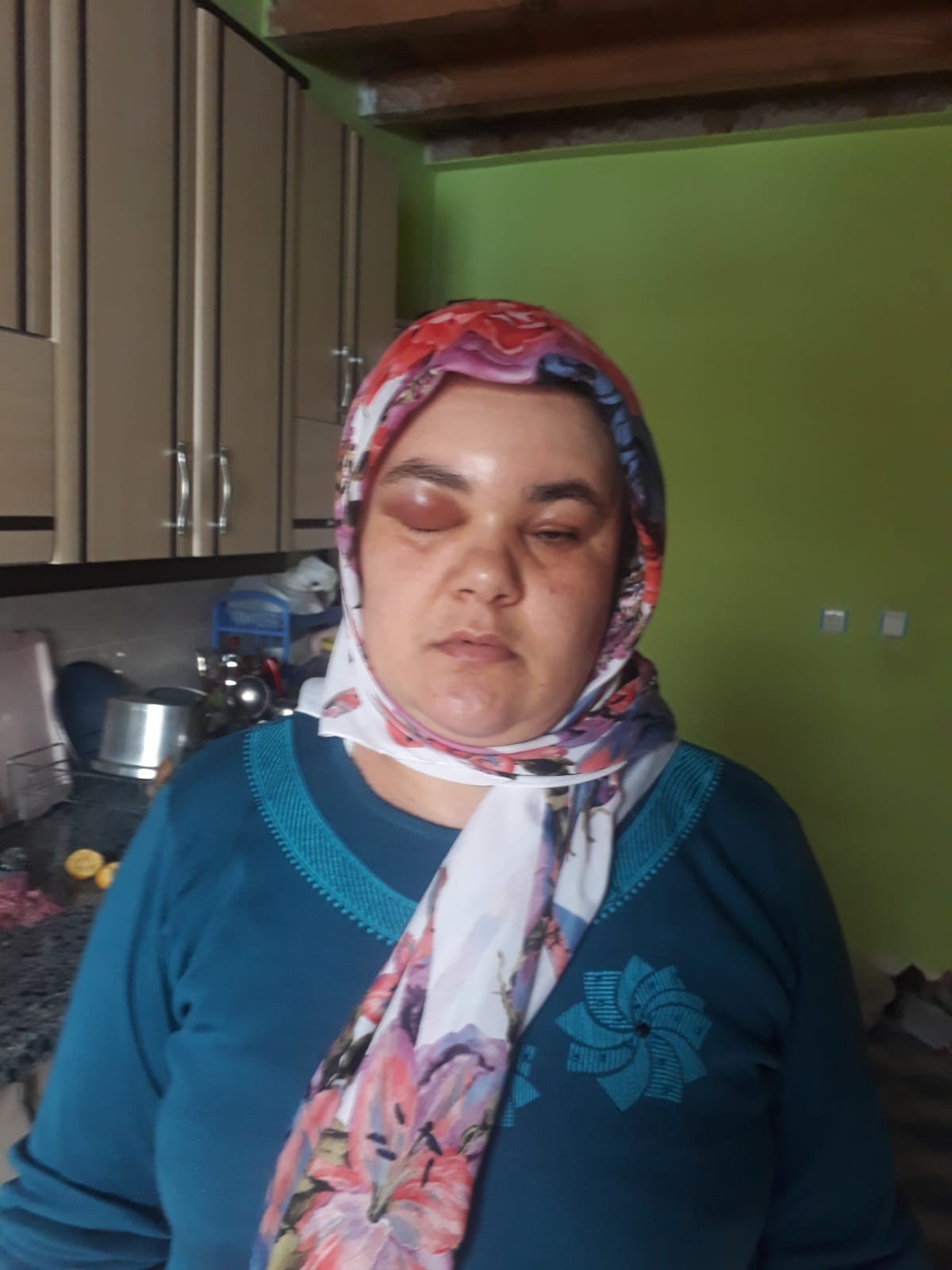 Miras yüzünden darp edilen kadın Babam gibi öldürülmek