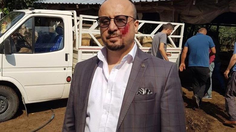 Haciz sırasında avukatın yanağını ısıran kişinin cezası belli oldu