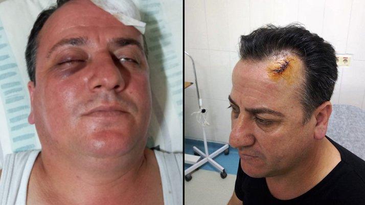AKP’li başkan yardımcısı ve adamları taksici dövdü