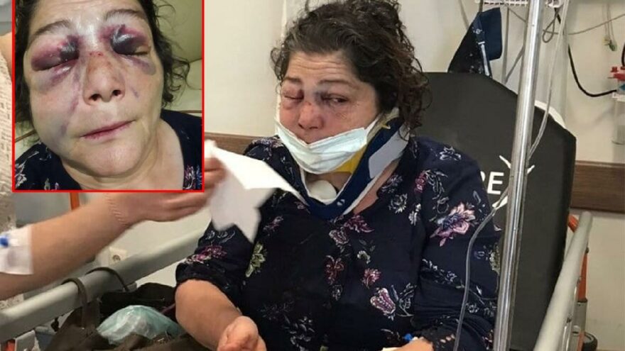 Belediye başkanı parkta ‘kadın dövdürdü’ iddiası