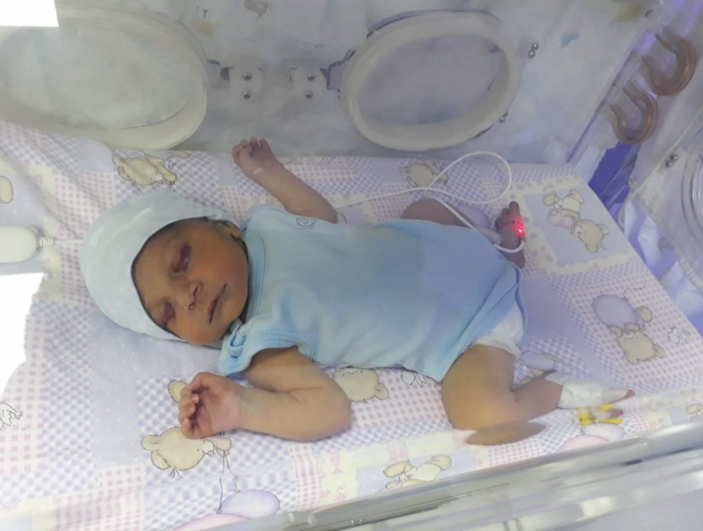 Yeni doğan Azra bebek kafasında kırıkla ailesine teslim