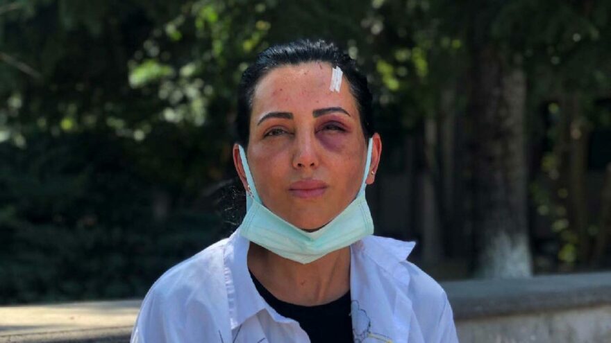 Eski sevgilisinin takside dövdüğü Habibe: 20 dakika boyunca darp etti