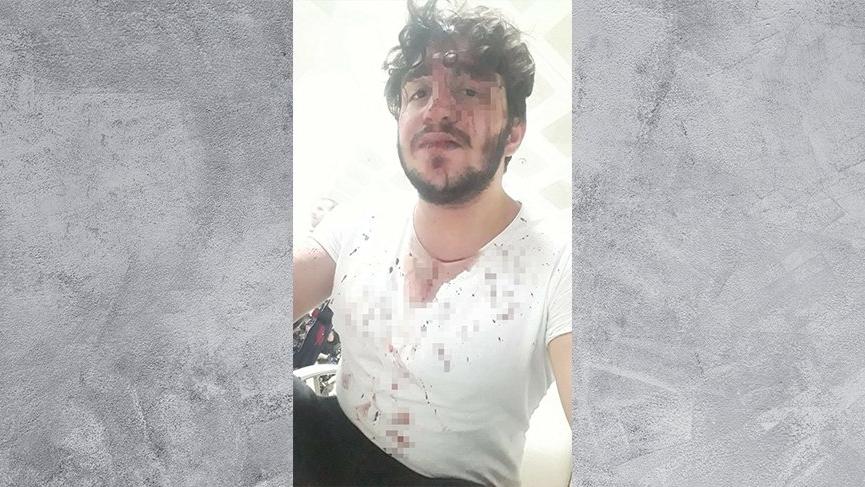 Ayrıldığı kız arkadaşı kabusu oldu