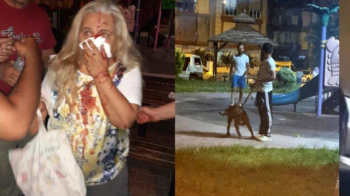 Çocuk parkında pitbullar saldırdı