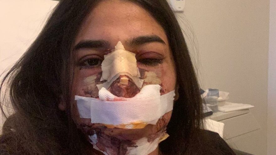 Nişantaşı’ndaki estetik kliniğinde bu hale geldi
