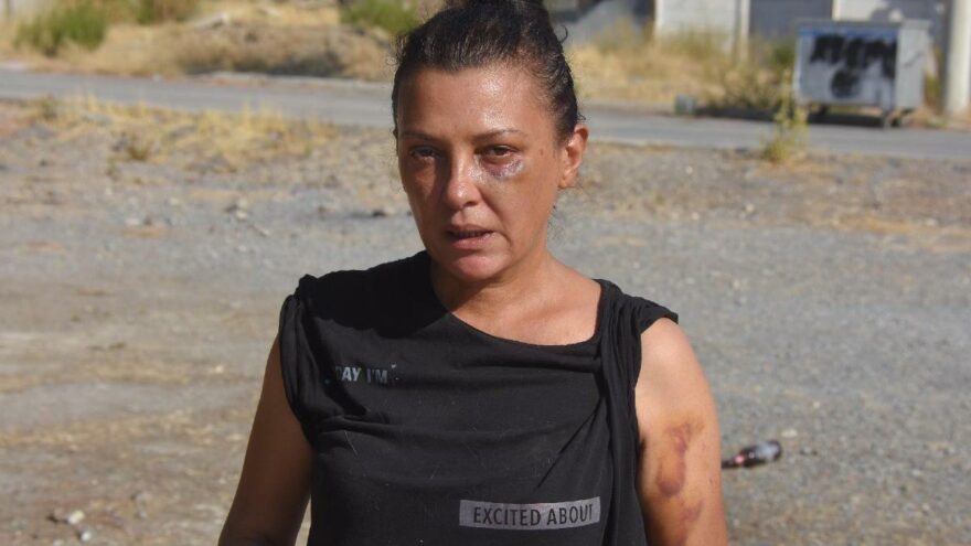 İzmir’deki darp iddiasında her iki taraf da şikayetçi