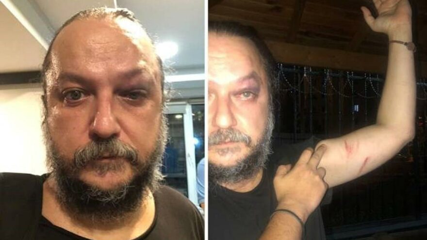 Opera sanatçısı 30 Ağustos konseri sonrası saldırıya uğradı