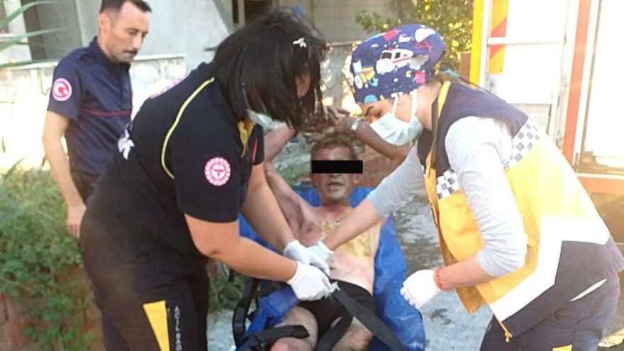 İnşaatta yanan çöpleri söndürmeye çalışan kişi yandı