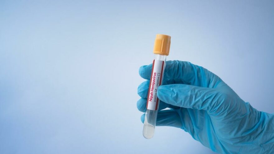 Nipah virüsü alarmı verildi: Yarasalardan bulaşıyor