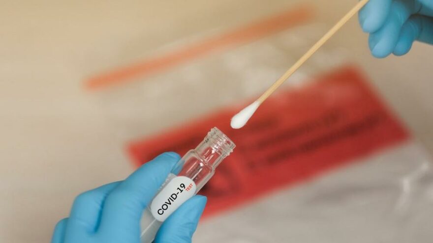 Terden coronavirüsünü teşhis eden test geliştirdiler