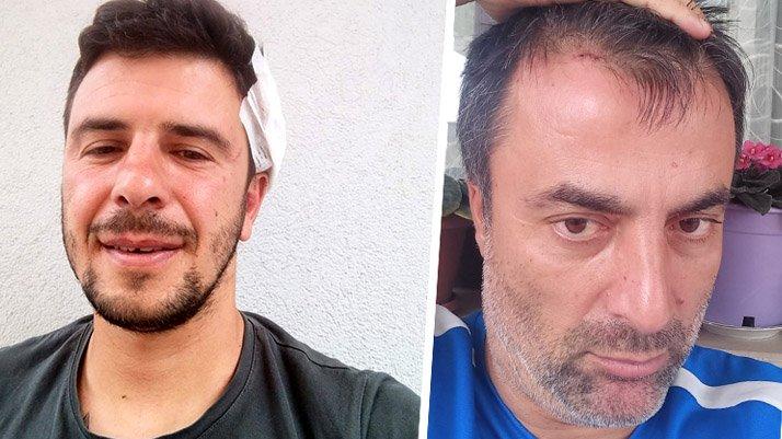 Antrenörlerin futbol sohbetinde levyeli kavga!