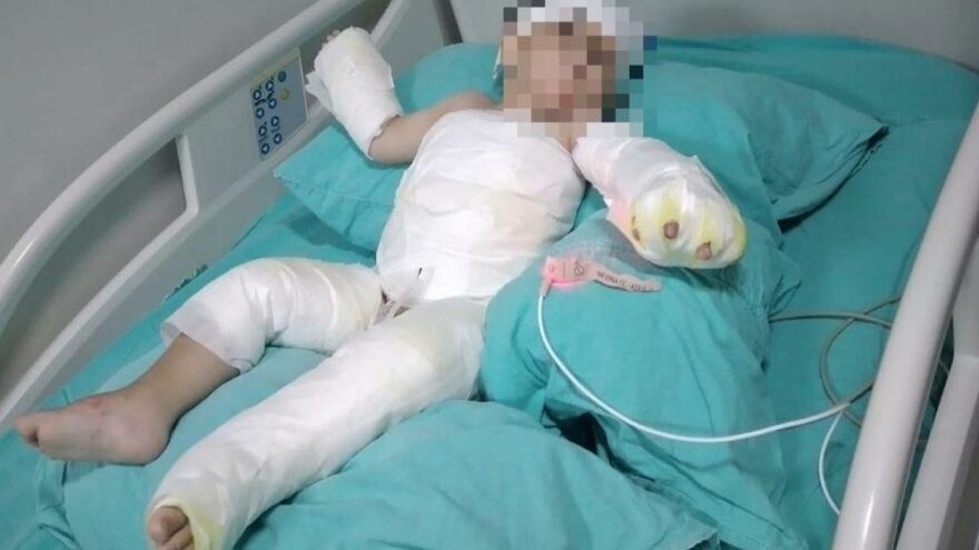 Kolonyalı vahşet: Eşini ve bebeğini yaktı