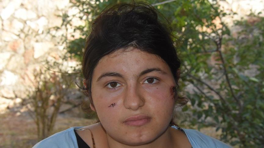 Kocası tarafından darbedilen kadın: Allah rızası için bana yardım etsinler