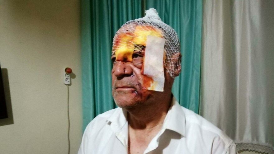 Yeniden Refah Partisi İlçe Başkanı’na sopalı saldırı
