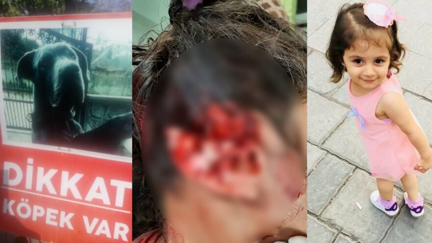 Alaz’ın köpek saldırısında kopan kulağına 300 dikiş