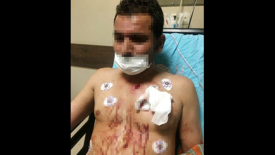 Uygunsuz fotoğraflarını paylaşan erkek arkadaşını göğsünden bıçakladı