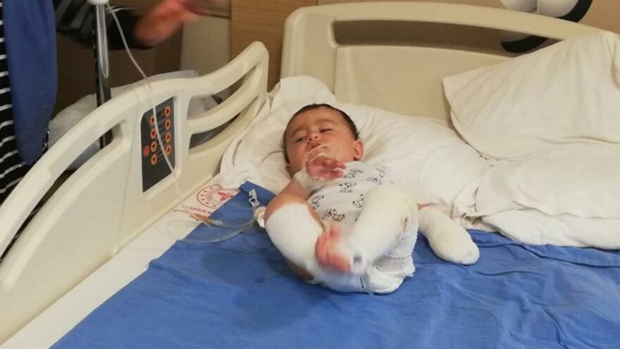 10 aylık bebeğin üzerine çaydanlık devrildi