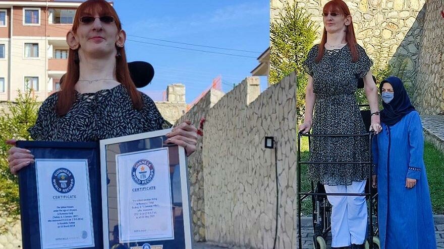 Dünyanın en uzun kadını konuştu: Farklı olmak kötü bir şey değil